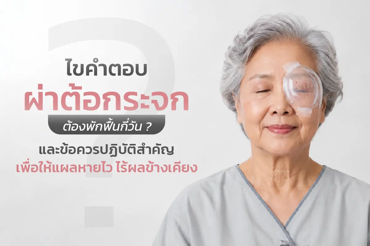 ไขคำตอบ: ผ่าต้อกระจกต้องพักฟื้นกี่วัน? และข้อควรปฏิบัติสำคัญเพื่อให้แผลหายไว ไร้ผลข้างเคียง